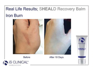 
                
                    Load image into Gallery viewer, iS Clinical SHEALD Recovery Balm
                
            